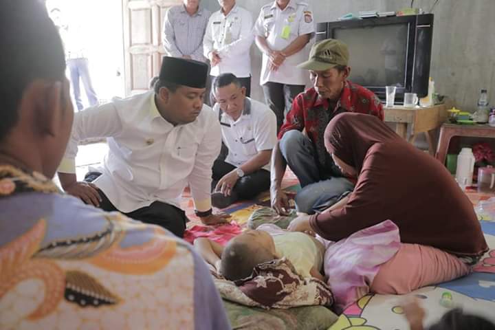 Walikota Tanjungbalai HM Syahrial saat menjenguk bocah penderita tumor ganas