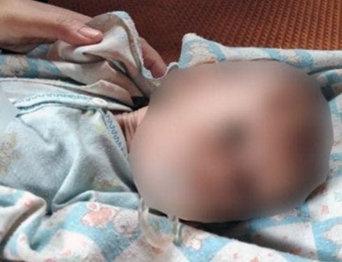 Bayi di Tapsel yang dianiaya Ibunya