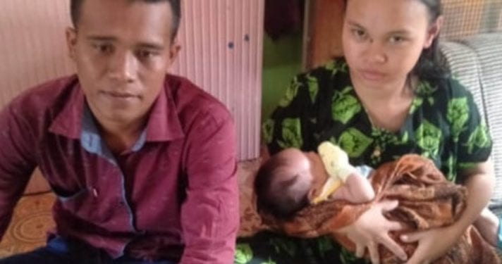 Tak Punya Anus, Bayi di Simalungun Ini Selalu Nangis Saat Mau BAB