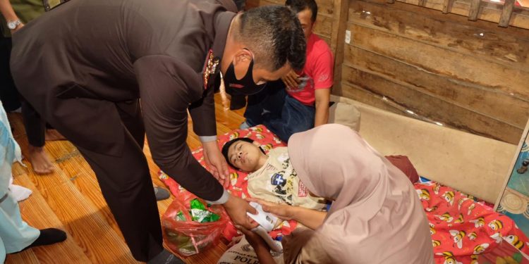 Kapolres Tanjungbalai berikan bantuan kepada keluarga anak penderita kurang gizi.