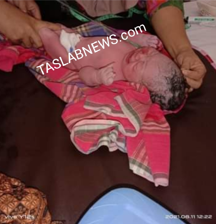 Ini Wajah Bayi yang Dibuang di Areal Perkebunan di Bandar Pulau Asahan